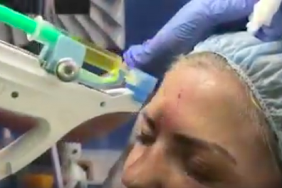 Autotransplantát krevní plazmy Autotransplantát krevní plazmy