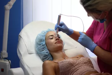 Microneedling-Behandlung
