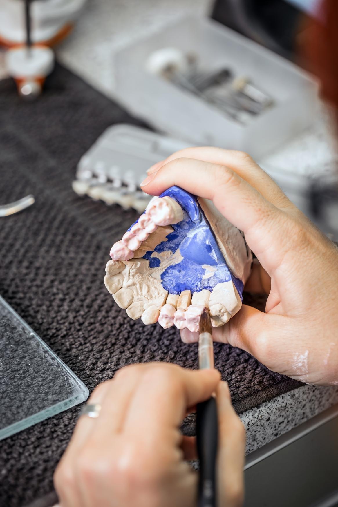 Prosthetics