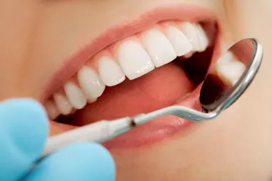 Dentální hygiena