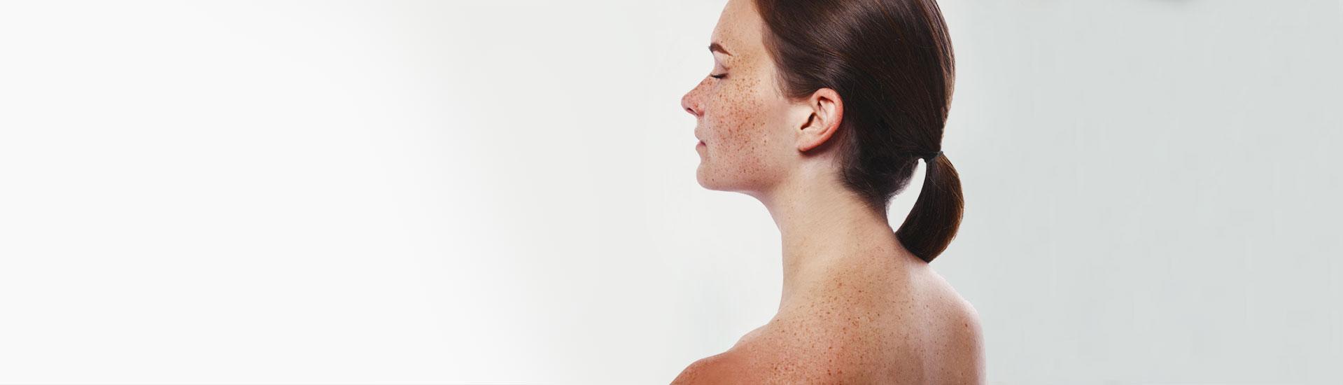 Treatment of pigmentation