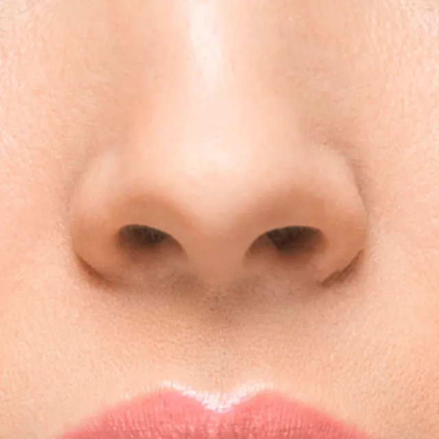 Nose and surrounding areas