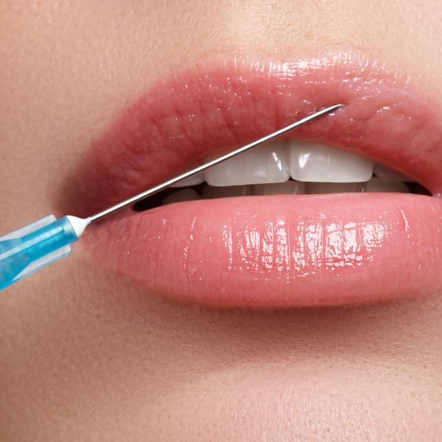 Lippenmodellierung