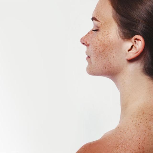 Pigmentation-Therapie