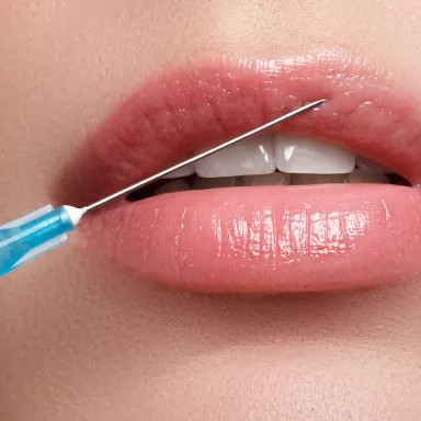 Lip augmentation