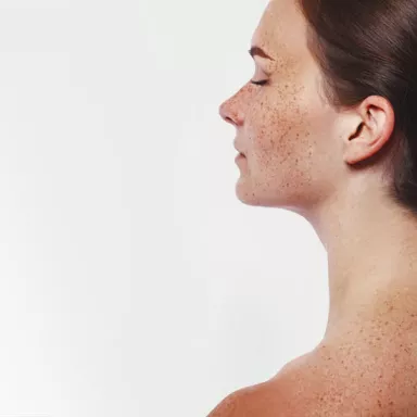 Treatment of pigmentation